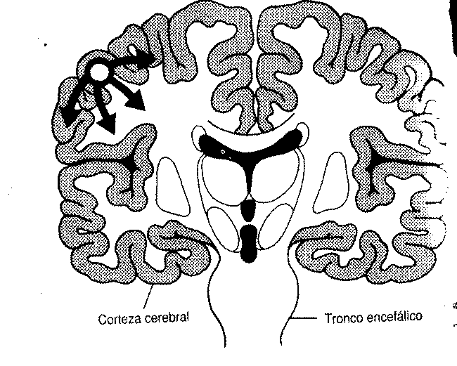 'Epilepsia'