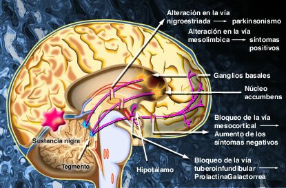 Haldol antipsychotic